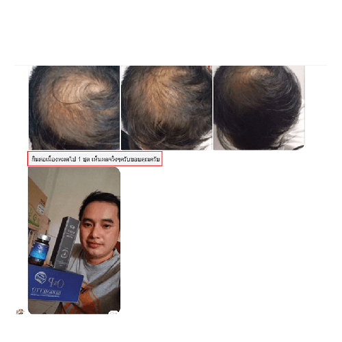 202101_05 - แคปแชท Line_2-10