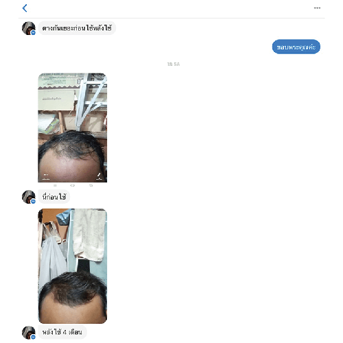 202101_05 - แคปแชท Line_2-13