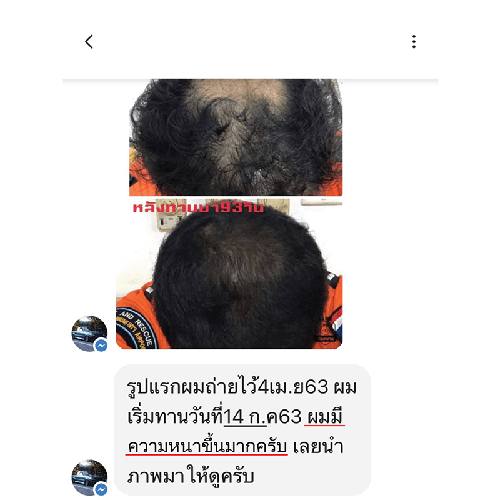 202101_05 - แคปแชท Line_2-23