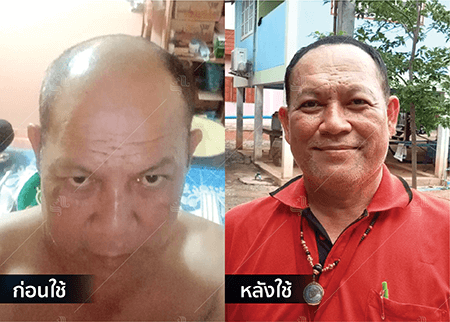 202208_19 - HERRMETTO Landing Page Youtube Skip AdsGDN-01