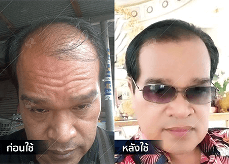 202208_19 - HERRMETTO Landing Page Youtube Skip AdsGDN-02