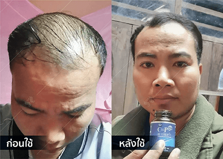 202208_19 - HERRMETTO Landing Page Youtube Skip AdsGDN-03