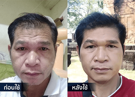 202208_19 - HERRMETTO Landing Page Youtube Skip AdsGDN-05