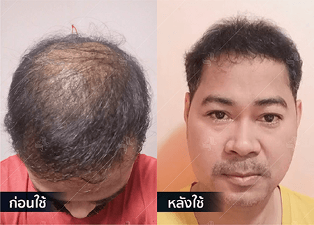 202208_19 - HERRMETTO Landing Page Youtube Skip AdsGDN-09