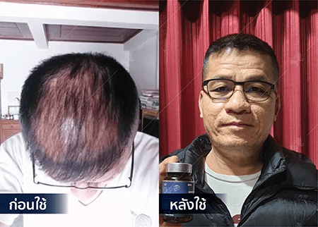 202208_19 - HERRMETTO Landing Page Youtube Skip AdsGDN-10