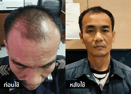 202208_19 - HERRMETTO Landing Page Youtube Skip AdsGDN-16