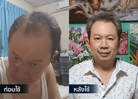 202208_19 - HERRMETTO Landing Page Youtube Skip AdsGDN-17