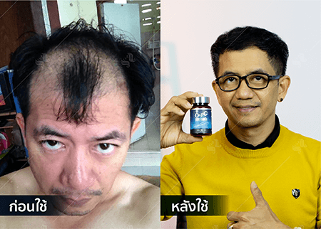 202208_19 - HERRMETTO Landing Page Youtube Skip AdsGDN-19