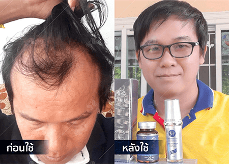 202208_19 - HERRMETTO Landing Page Youtube Skip AdsGDN-20