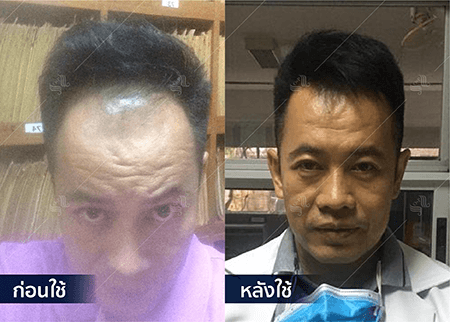 202208_19 - HERRMETTO Landing Page Youtube Skip AdsGDN-22