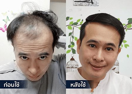 202208_19 - HERRMETTO Landing Page Youtube Skip AdsGDN-26