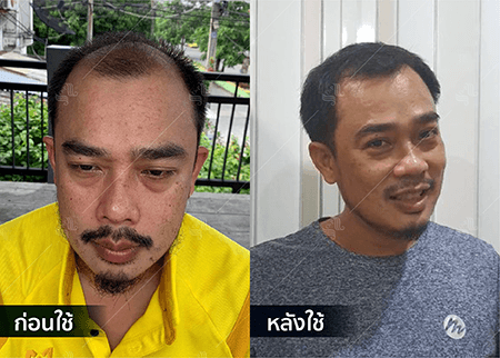 202208_19 - HERRMETTO Landing Page Youtube Skip AdsGDN-28