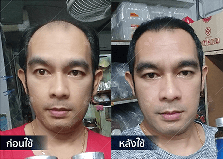 202208_19 - HERRMETTO Landing Page Youtube Skip AdsGDN-30