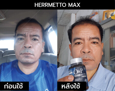รีวิว herrmetto max01