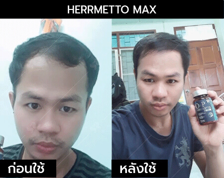 รีวิว herrmetto max02