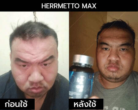 รีวิว herrmetto max03