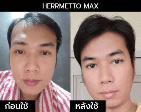 รีวิว herrmetto max04