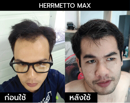 รีวิว herrmetto max05
