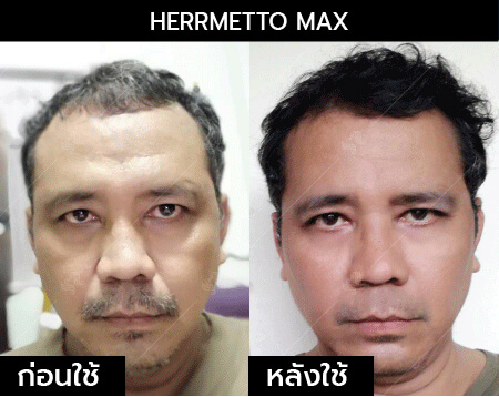 รีวิว herrmetto max06