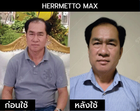 รีวิว herrmetto max07