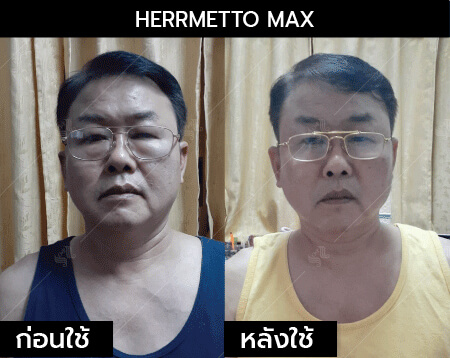 รีวิว herrmetto max08
