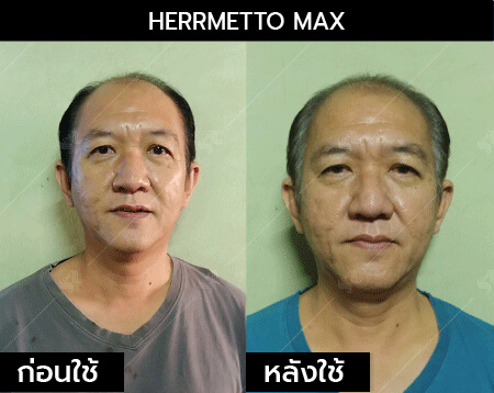 รีวิว herrmetto max09