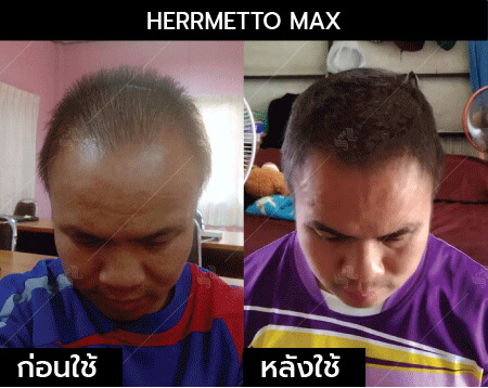 รีวิว herrmetto max10