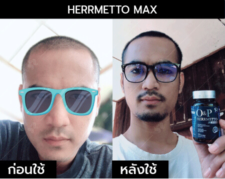 รีวิว herrmetto max11