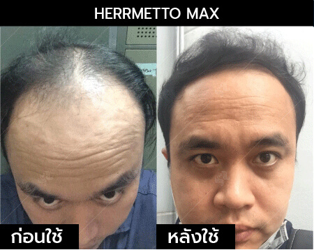 รีวิว herrmetto max12