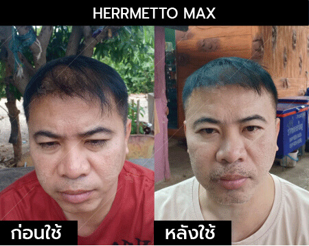 รีวิว herrmetto max13