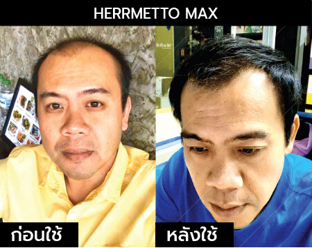 รีวิว herrmetto max14
