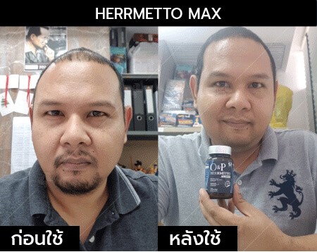 รีวิว herrmetto max16
