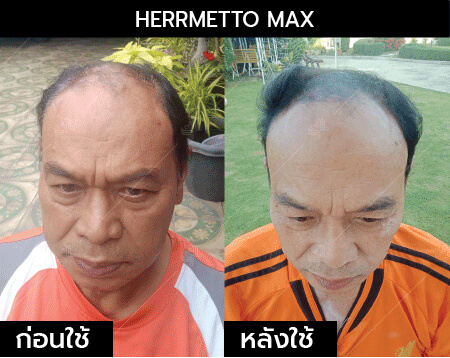 รีวิว herrmetto max17