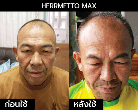 รีวิว herrmetto max18
