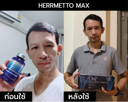 รีวิว herrmetto max19