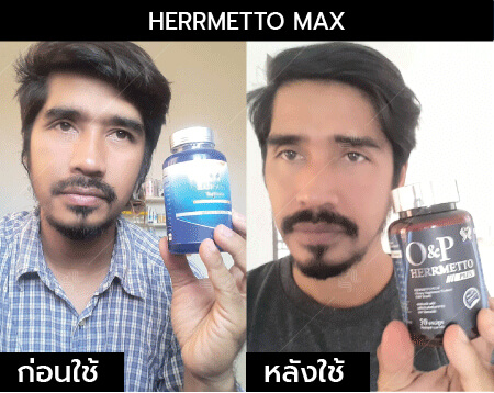 รีวิว herrmetto max20