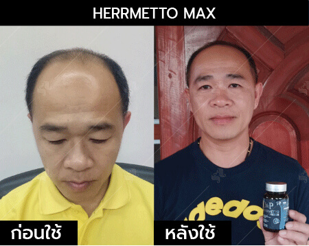 รีวิว herrmetto max21