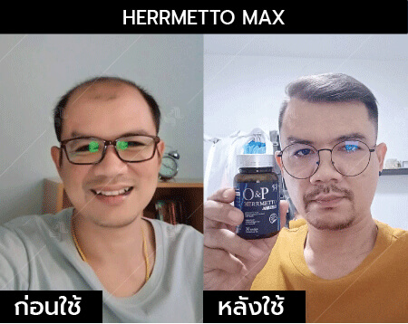 รีวิว herrmetto max22