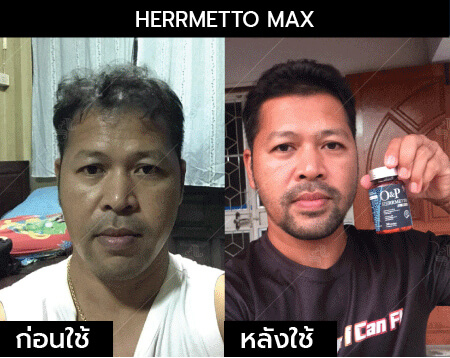 รีวิว herrmetto max23