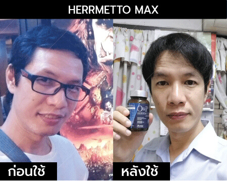 รีวิว herrmetto max24