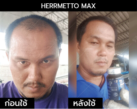 รีวิว herrmetto max25